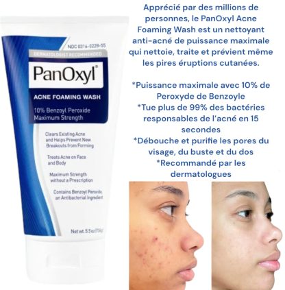 PanOxyl Acne Foaming Wash Benzoyl Peroxide 10% Maximum Strength – Image 2